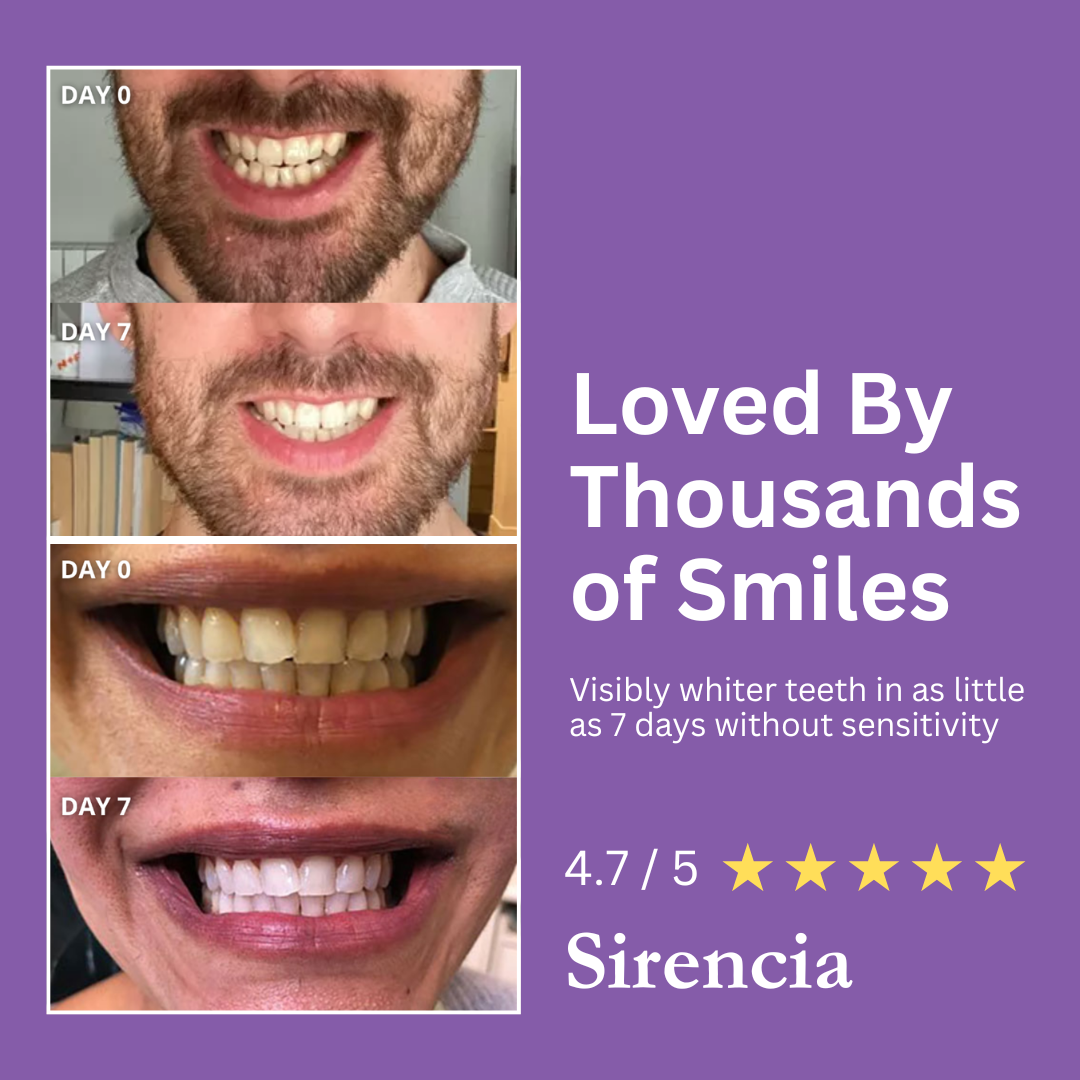 Flex-Fit Purple Whitening Strips