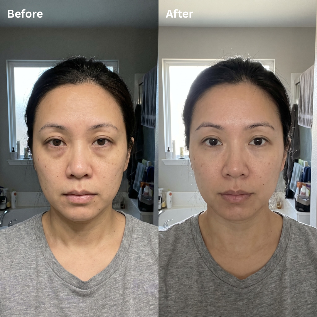 Sirencia Micro-Infusion Eye Patches