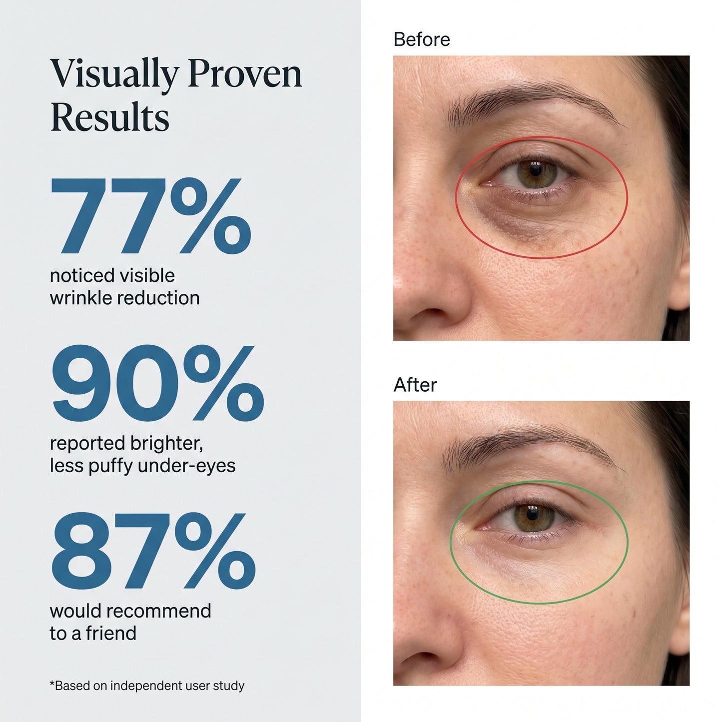 Sirencia Micro-Infusion Eye Patches