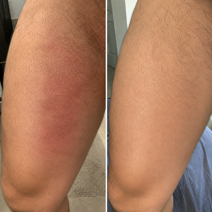 All-Day Relief & Protection from Chafing