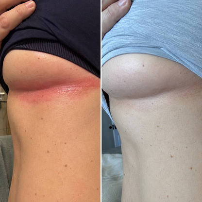 All-Day Relief & Protection from Chafing